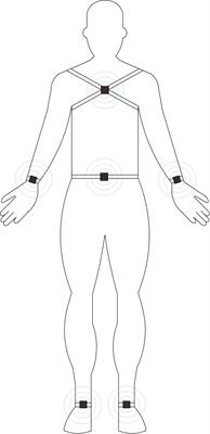Detection of Motor Dysfunction With Wearable Sensors in Patients With Idiopathic Rapid Eye Movement Disorder